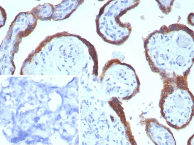 EBI3/Epstein-Barr virus induced 3 Antibody in Immunohistochemistry (Paraffin) (IHC (P))