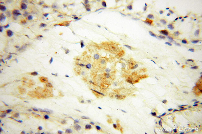 NSE Antibody in Immunohistochemistry (Paraffin) (IHC (P))