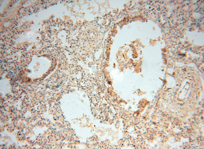 NSE Antibody in Immunohistochemistry (Paraffin) (IHC (P))