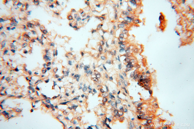 NSE Antibody in Immunohistochemistry (Paraffin) (IHC (P))