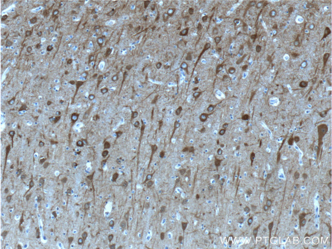 NSE Antibody in Immunohistochemistry (Paraffin) (IHC (P))