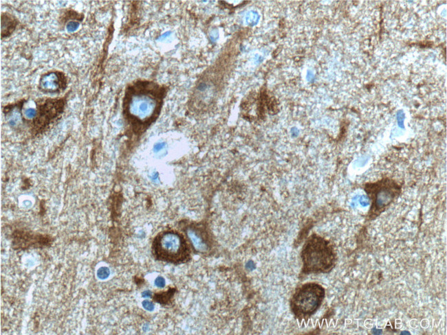 NSE Antibody in Immunohistochemistry (Paraffin) (IHC (P))