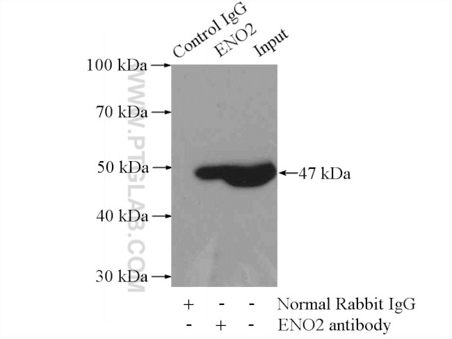 NSE Antibody in Immunoprecipitation (IP)