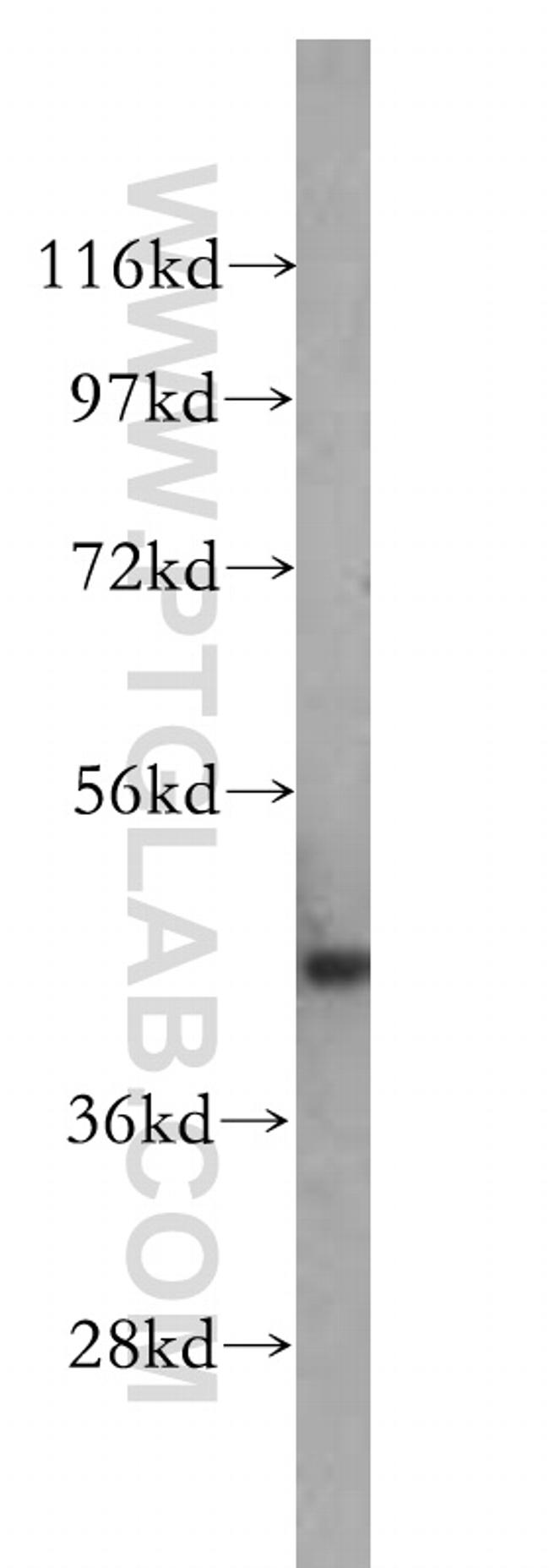 NSE Antibody in Western Blot (WB)