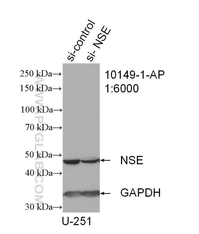 NSE Antibody in Western Blot (WB)