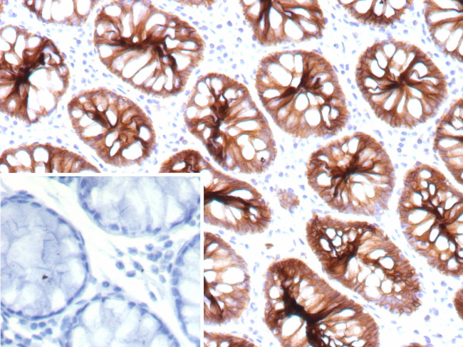 Cadherin 17/LI Cadherin (Liver-Intestine Marker) Antibody in Immunohistochemistry (Paraffin) (IHC (P))