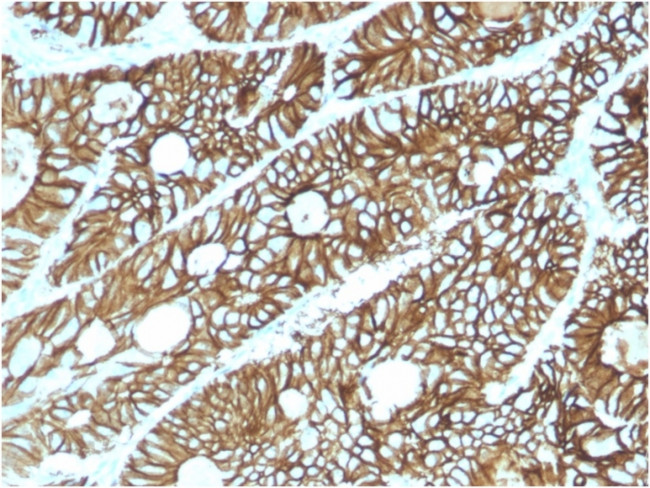 Cadherin 17/LI Cadherin Antibody in Immunohistochemistry (Paraffin) (IHC (P))