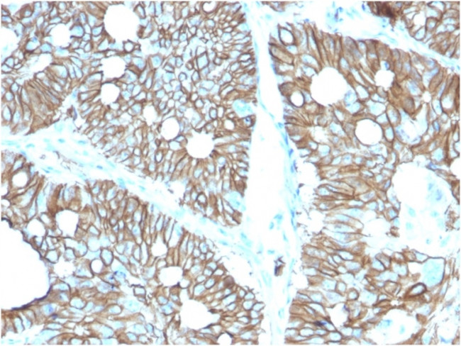 Cadherin 17/LI Cadherin (Liver-Intestine Marker) Antibody in Immunohistochemistry (Paraffin) (IHC (P))