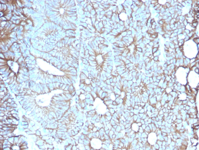 Cadherin 17/LI Cadherin (Liver-Intestine Marker) Antibody in Immunohistochemistry (Paraffin) (IHC (P))
