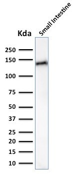 Cadherin 17/LI Cadherin (Liver-Intestine Marker) Antibody in Western Blot (WB)