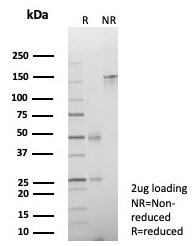 Cadherin 17/LI Cadherin (Liver-Intestine Marker) Antibody in SDS-PAGE (SDS-PAGE)