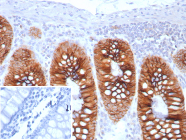 Cadherin 17/LI Cadherin (Liver-Intestine Marker) Antibody in Immunohistochemistry (Paraffin) (IHC (P))