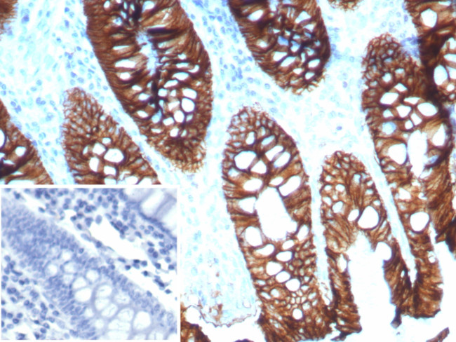 Cadherin 17/LI Cadherin (Liver-Intestine Marker) Antibody in Immunohistochemistry (Paraffin) (IHC (P))