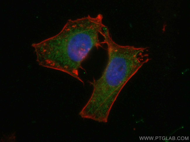 GNAS Antibody in Immunocytochemistry (ICC/IF)