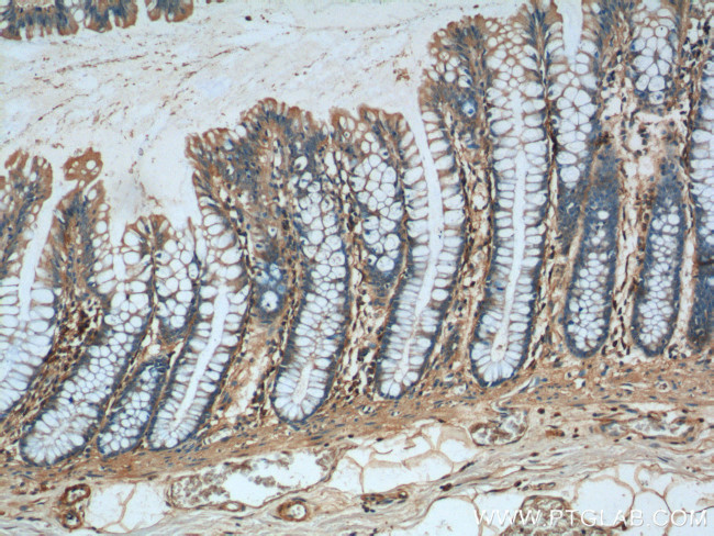 GNAS Antibody in Immunohistochemistry (Paraffin) (IHC (P))