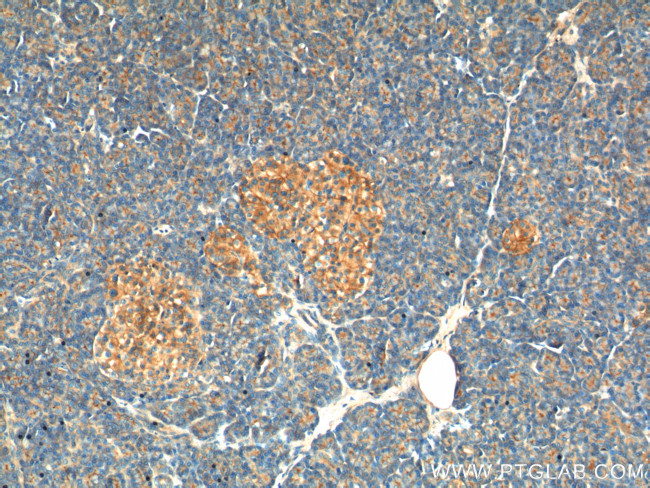 GNAS Antibody in Immunohistochemistry (Paraffin) (IHC (P))