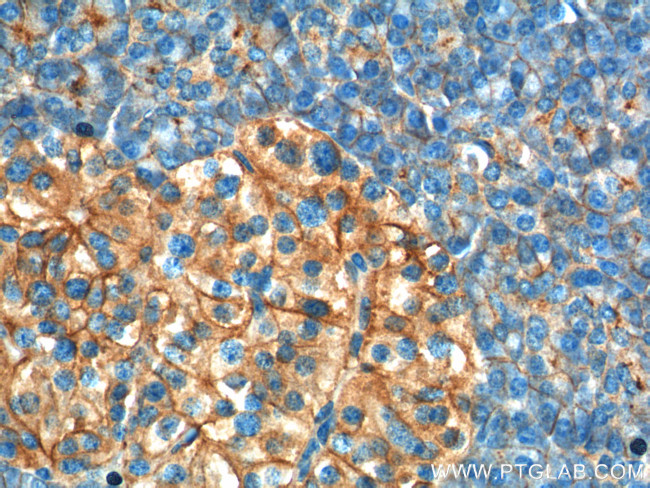 GNAS Antibody in Immunohistochemistry (Paraffin) (IHC (P))