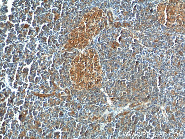 GNAS Antibody in Immunohistochemistry (Paraffin) (IHC (P))