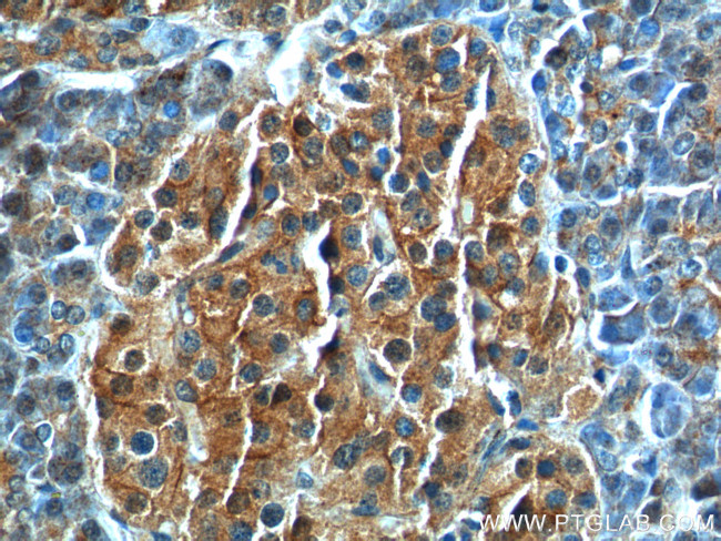 GNAS Antibody in Immunohistochemistry (Paraffin) (IHC (P))