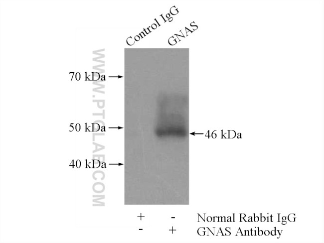 GNAS Antibody in Immunoprecipitation (IP)