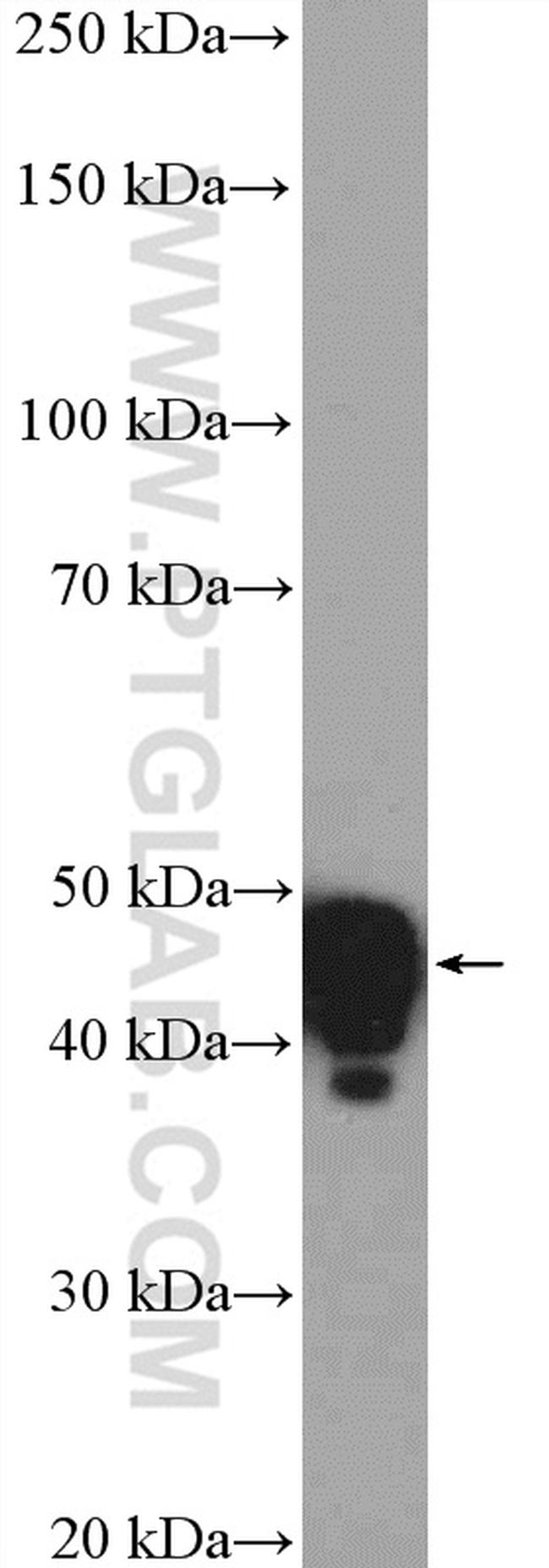 GNAS Antibody in Western Blot (WB)