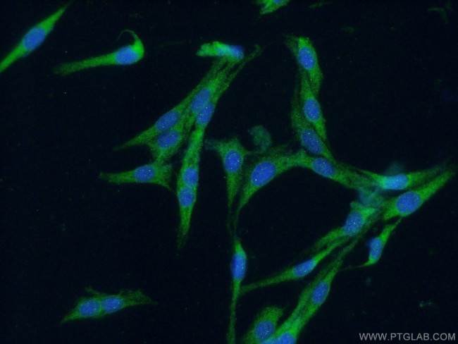 CDC42 Antibody in Immunocytochemistry (ICC/IF)