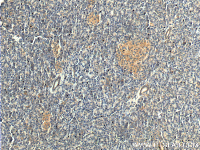 CDC42 Antibody in Immunohistochemistry (Paraffin) (IHC (P))