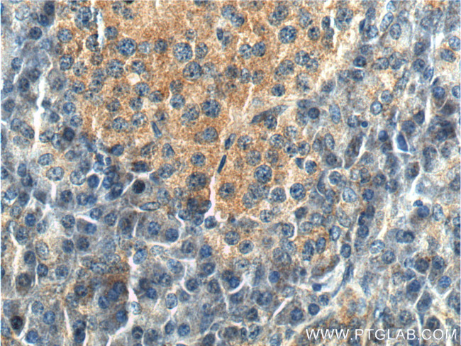 CDC42 Antibody in Immunohistochemistry (Paraffin) (IHC (P))