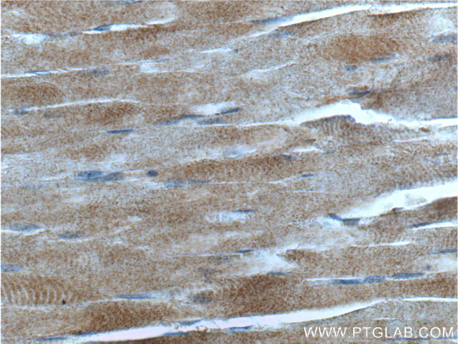 CDC42 Antibody in Immunohistochemistry (Paraffin) (IHC (P))