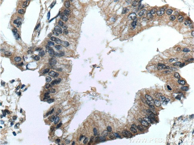 CDC42 Antibody in Immunohistochemistry (Paraffin) (IHC (P))