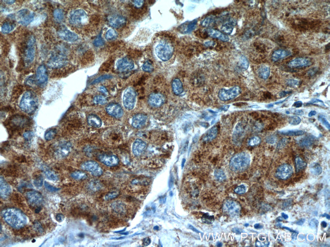 TUSC4 Antibody in Immunohistochemistry (Paraffin) (IHC (P))