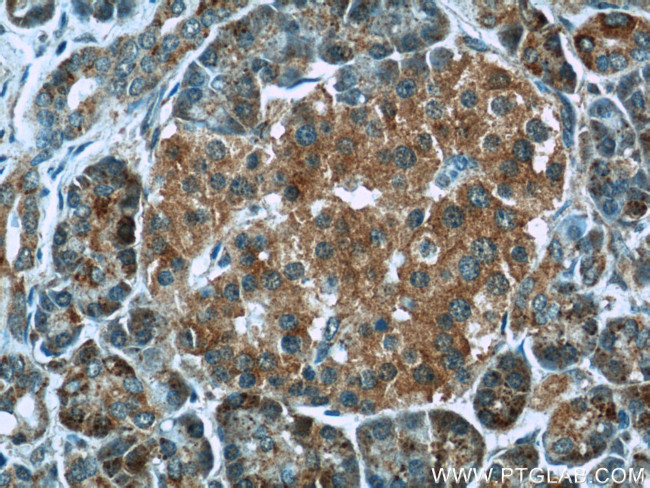 TUSC4 Antibody in Immunohistochemistry (Paraffin) (IHC (P))