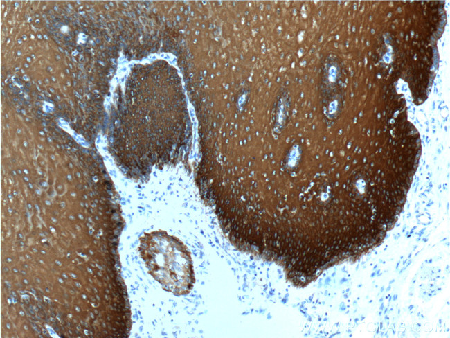 Cytokeratin 13 Antibody in Immunohistochemistry (Paraffin) (IHC (P))