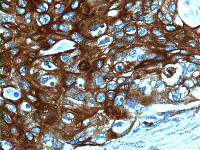 Cytokeratin 13 Antibody in Immunohistochemistry (Paraffin) (IHC (P))