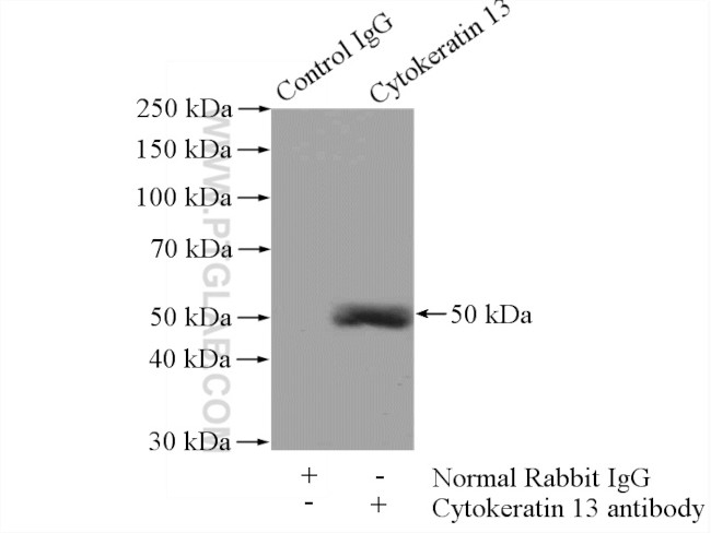 Cytokeratin 13 Antibody in Immunoprecipitation (IP)