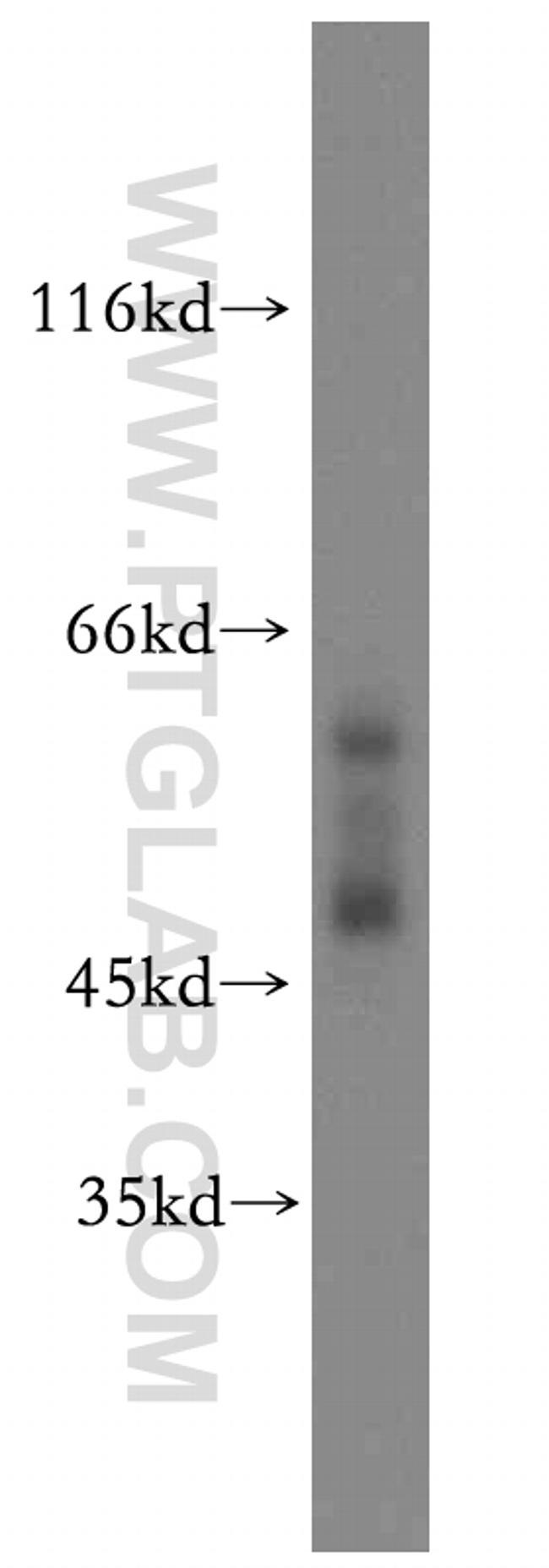 Cytokeratin 13 Antibody in Western Blot (WB)