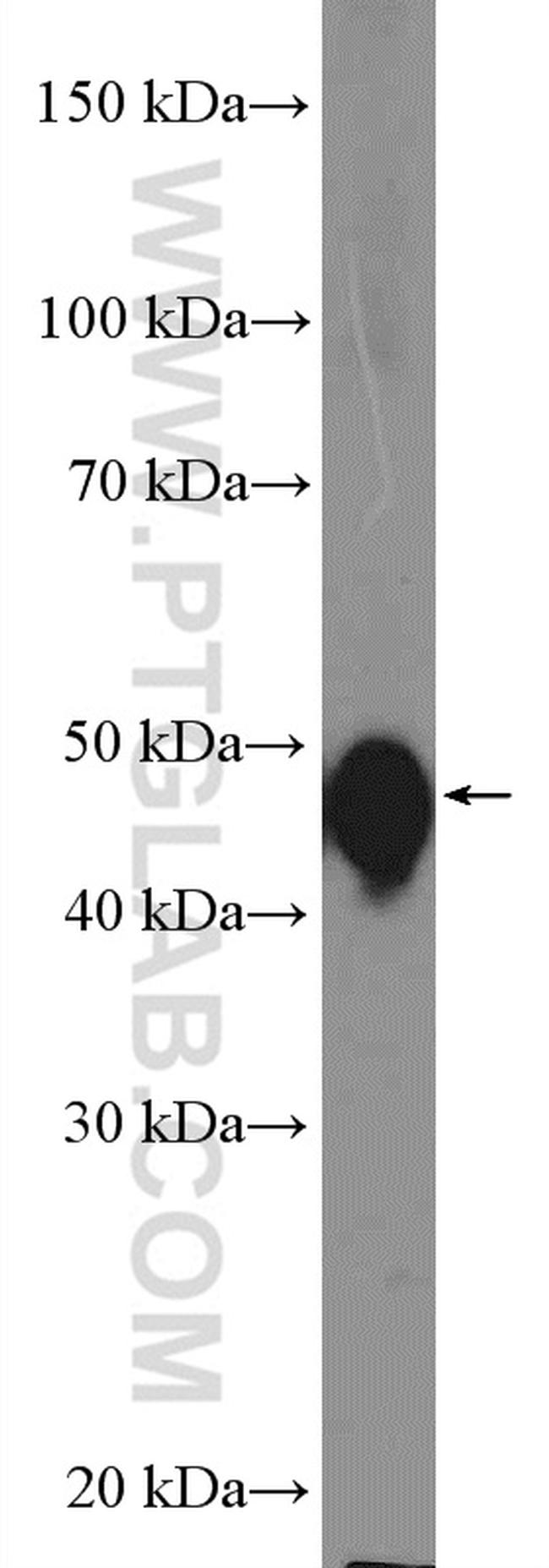 Cytokeratin 13 Antibody in Western Blot (WB)