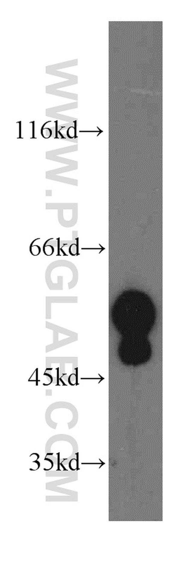 Cytokeratin 13 Antibody in Western Blot (WB)