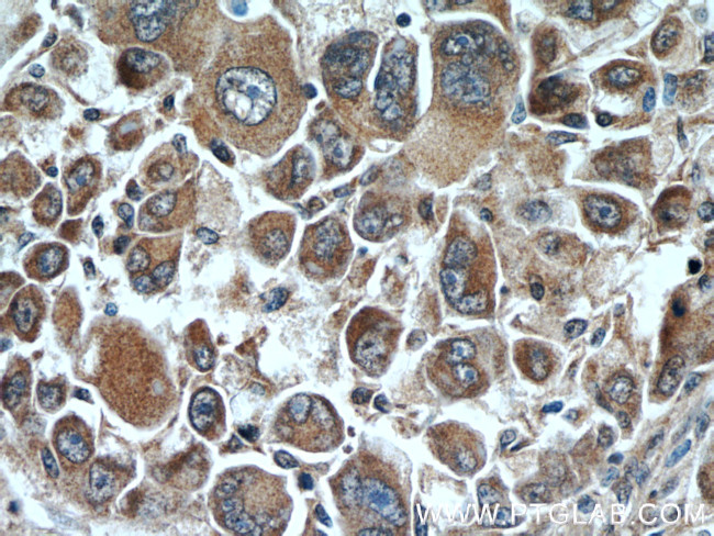 DOPA decarboxylase Antibody in Immunohistochemistry (Paraffin) (IHC (P))