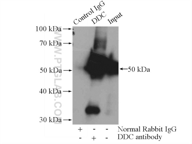 DOPA decarboxylase Antibody in Immunoprecipitation (IP)