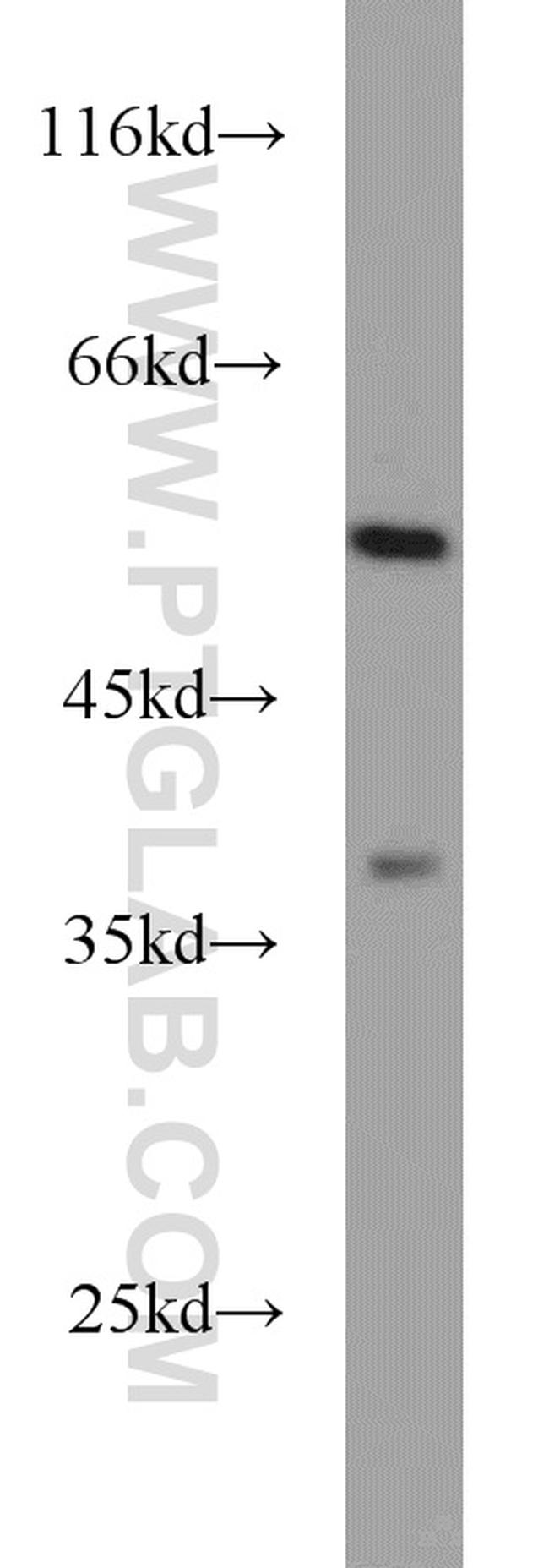 DOPA decarboxylase Antibody in Western Blot (WB)