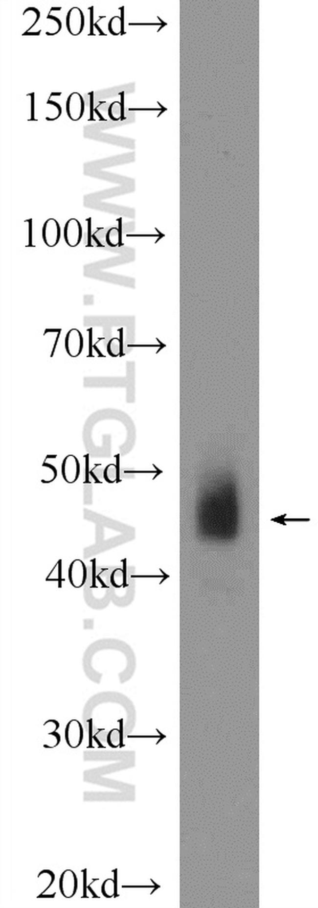 DOPA decarboxylase Antibody in Western Blot (WB)