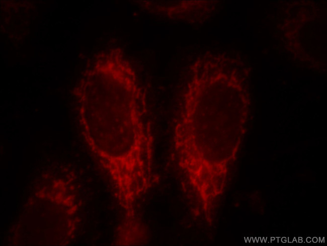 ACSM3 Antibody in Immunocytochemistry (ICC/IF)