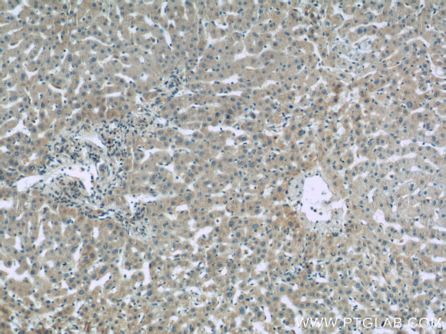 Complement factor B Antibody in Immunohistochemistry (Paraffin) (IHC (P))