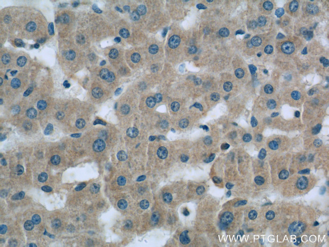 Complement factor B Antibody in Immunohistochemistry (Paraffin) (IHC (P))