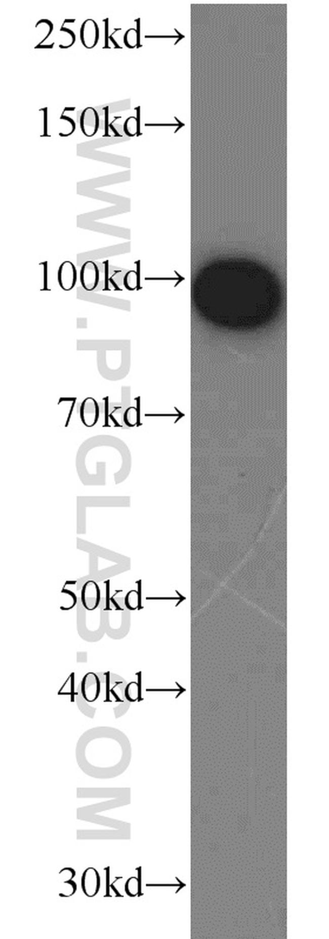 Complement factor B Antibody in Western Blot (WB)