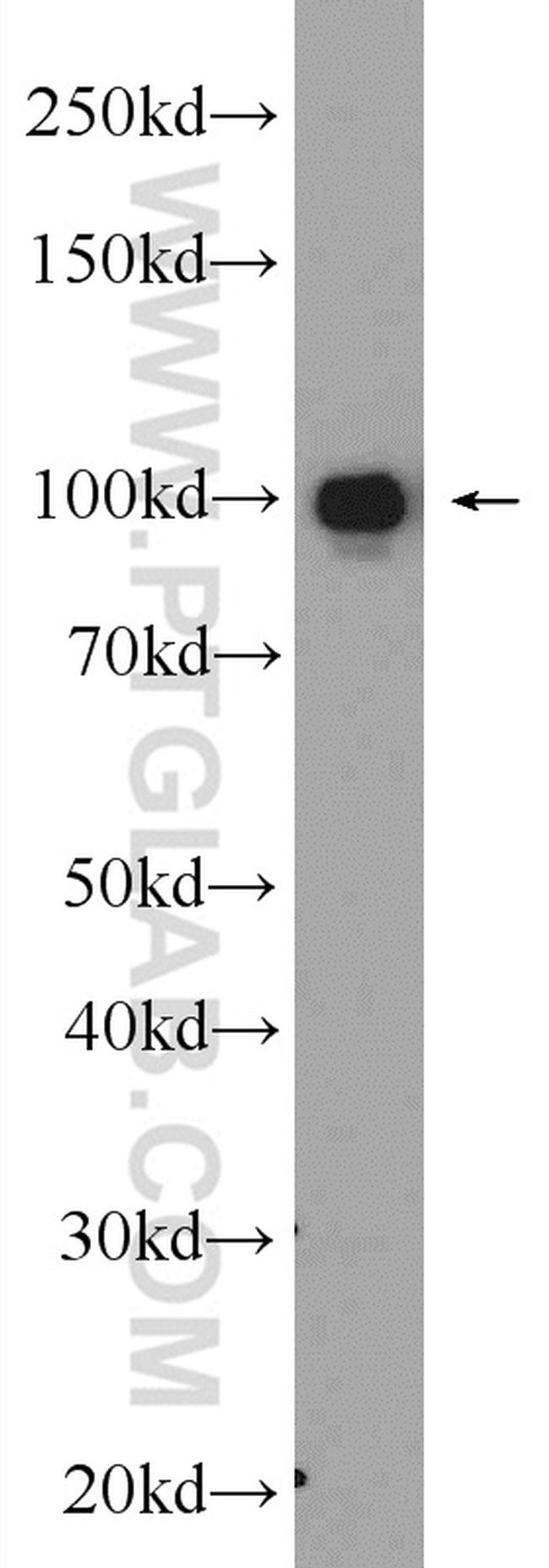 Complement factor B Antibody in Western Blot (WB)