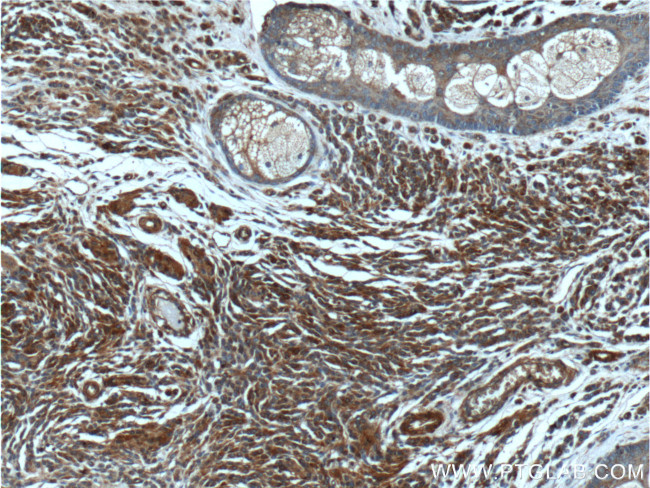 Beta Arrestin 2 Antibody in Immunohistochemistry (Paraffin) (IHC (P))