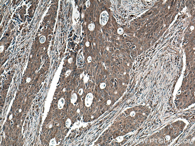 Beta Arrestin 2 Antibody in Immunohistochemistry (Paraffin) (IHC (P))