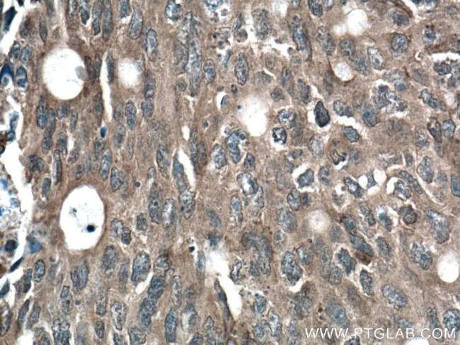 Beta Arrestin 2 Antibody in Immunohistochemistry (Paraffin) (IHC (P))